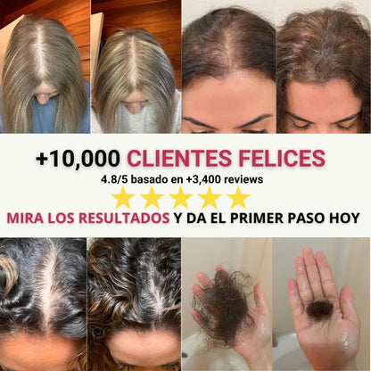 Lumi Scalp®